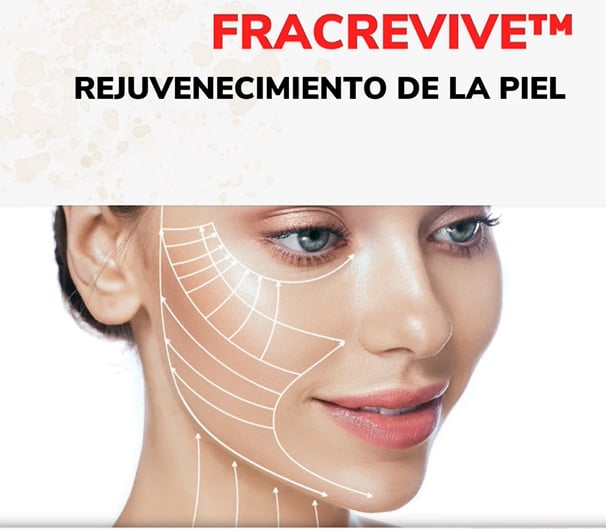 Fracrevive